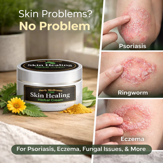 Skin Healing Herbal Cream for Psoriasis & Ringworm - Herb Wellness