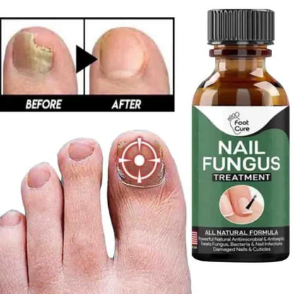 Nail fungus serum