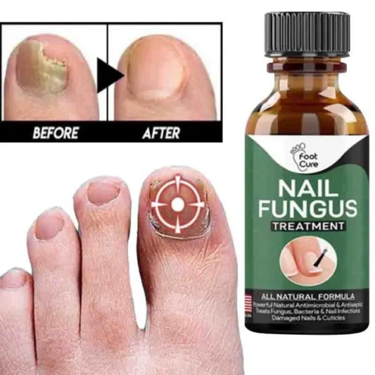 Nail fungus serum